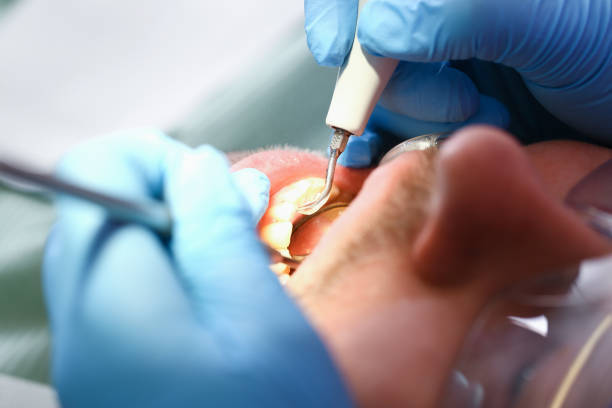 Best Emergency Orthodontic Repairs in Matheny, CA